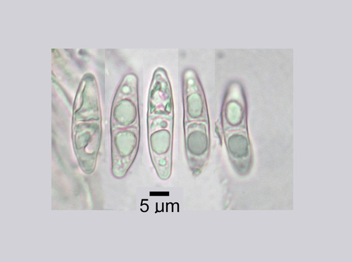 Polychidium muscicola - Spores