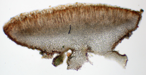 Polychidium muscicola - Apothecia