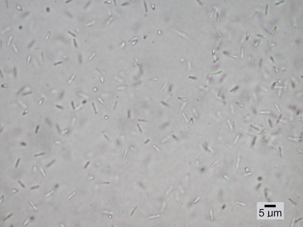 Hypogymnia austerodes - Spermatia