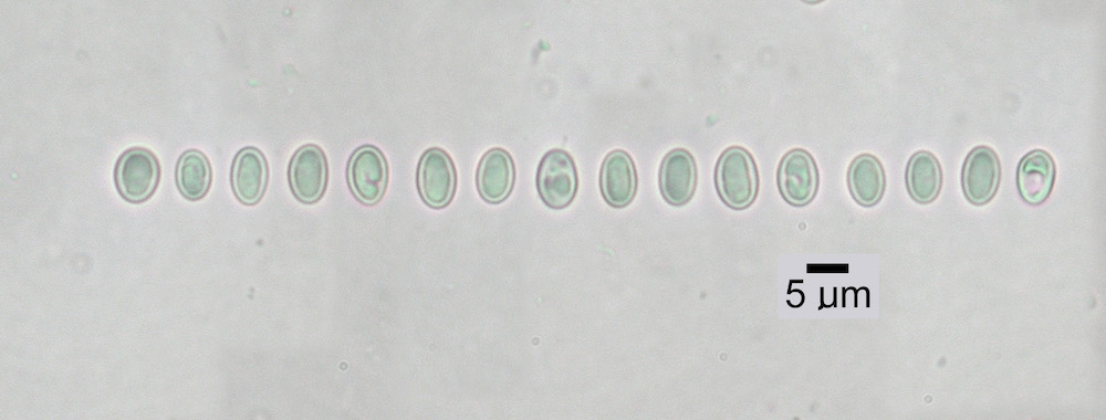 Hypogymnia gracilis - Ascospores