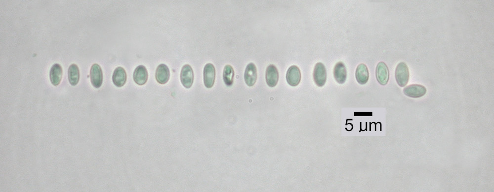 Hypogymnia heterophylla - Ascospores