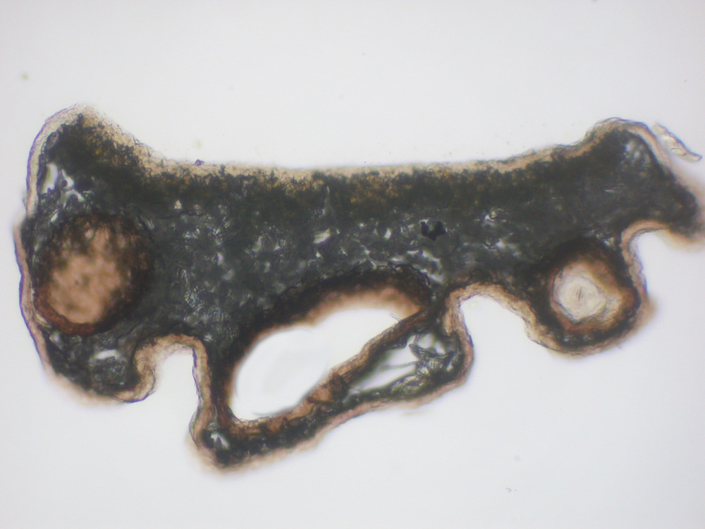Hypogymnia lophyrea - Thallus section with cavernulae