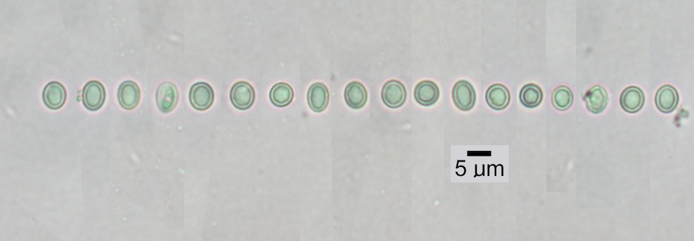 Hypogymnia vittata - Ascospores