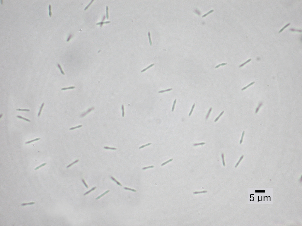 Hypogymnia imshaugii - Spermatia