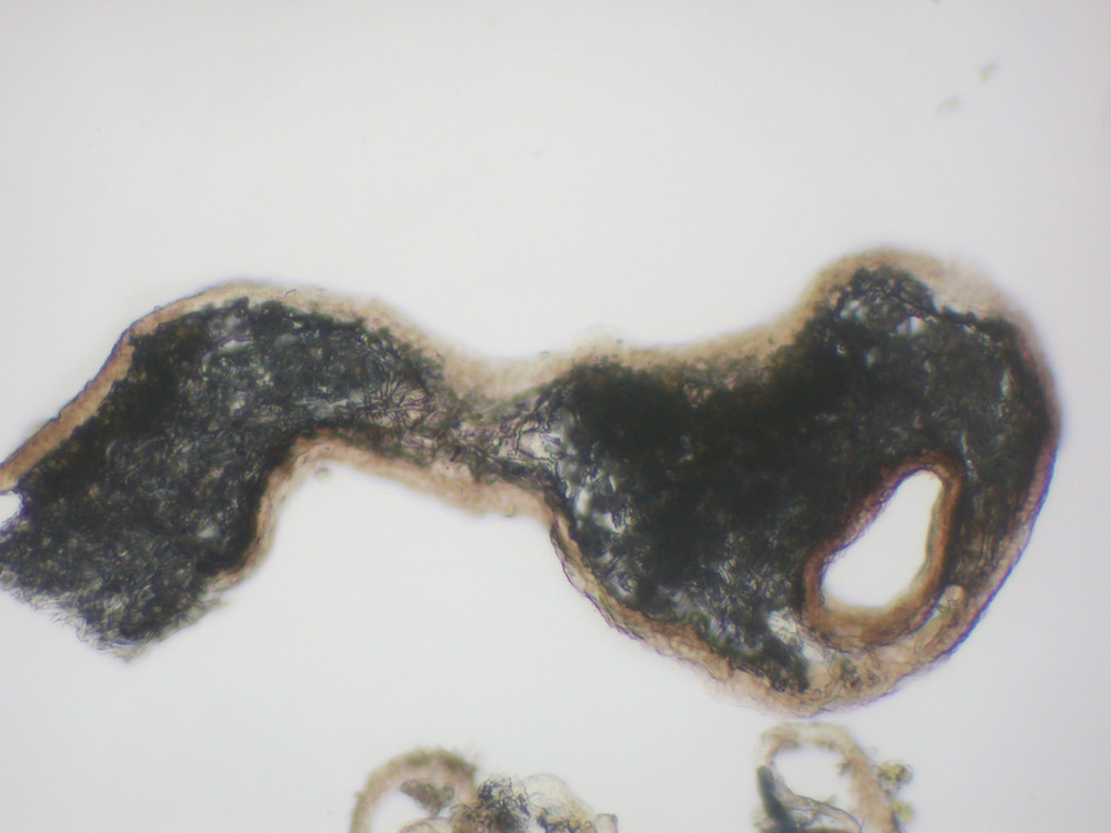 Hypogymnia lophyrea - Thallus section with cavernulae