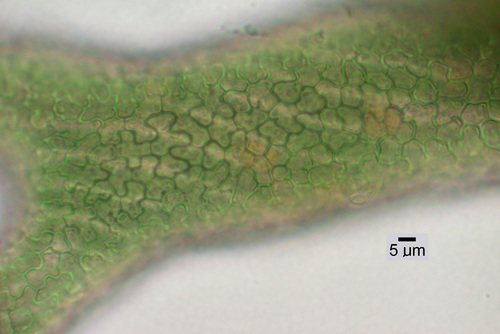 Leptogidium contortum - Cortex