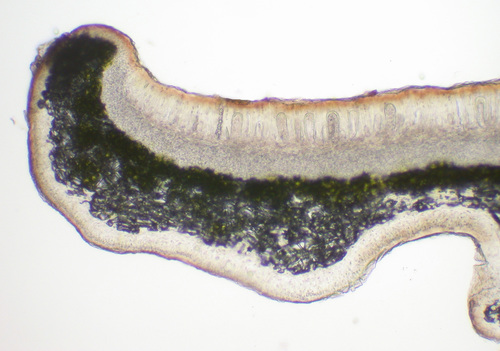 Melanohalea multispora - Apothecia