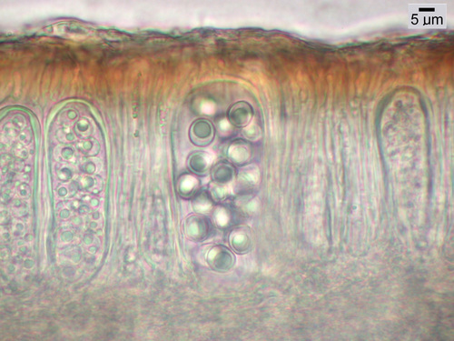 Melanohalea multispora - Hymenium