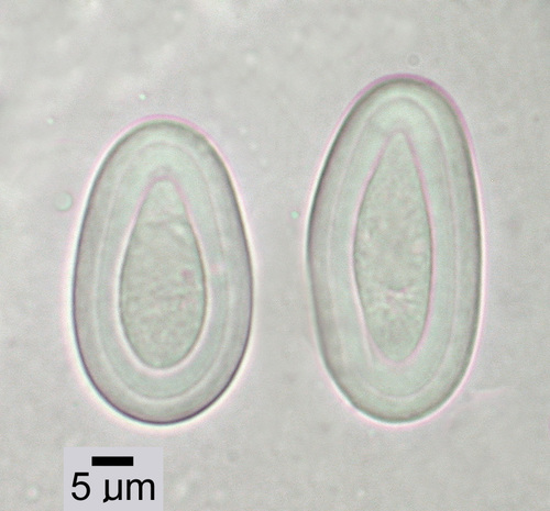 Menegazzia subsimilis - Spores