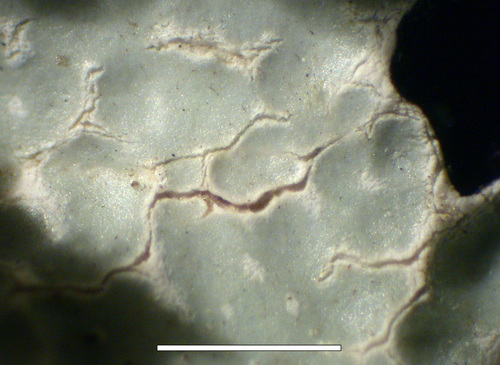 Parmelia sulcata - Pseudocyphellae