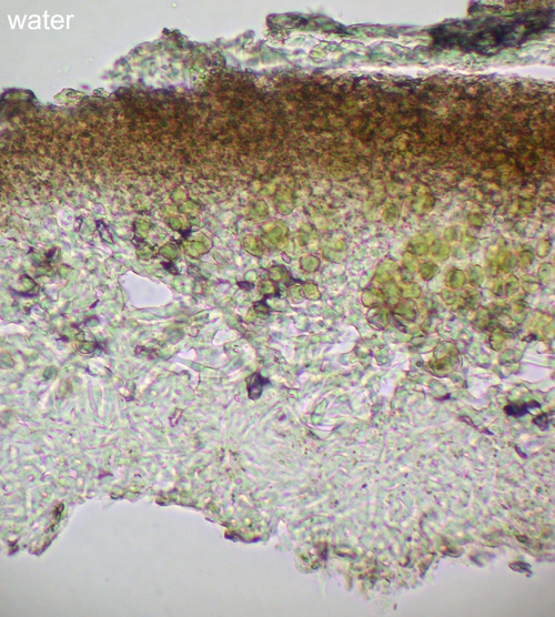 Physcia dubia - Thallus transverse section