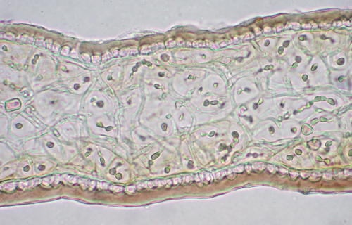 Scytinium lichenoides - Thallus section