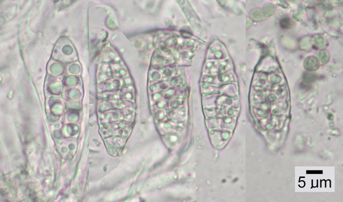 Scytinium polycarpum - Spores