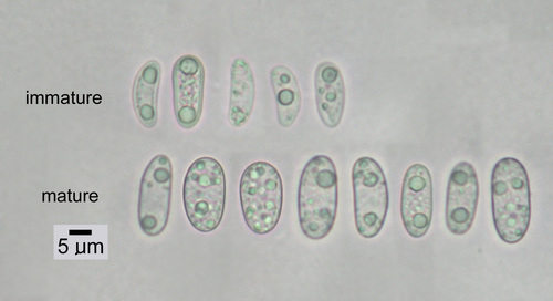 Umbilicaria hyperborea - Spores