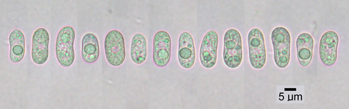 Umbilicaria phaea - Spores