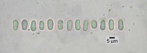 Umbilicaria torrefacta - Spores